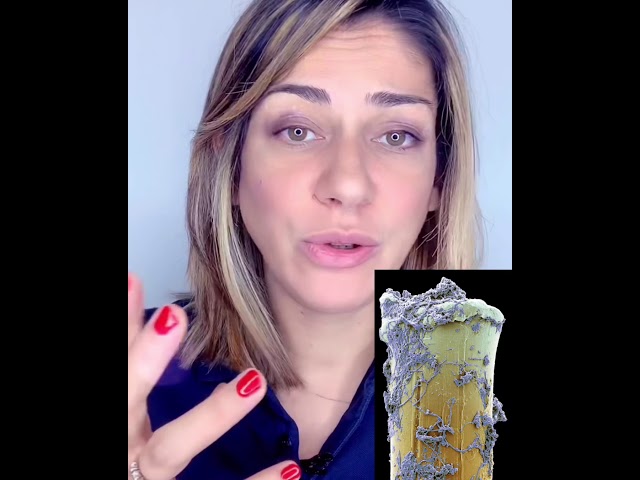 tartaro che si stacca da solo